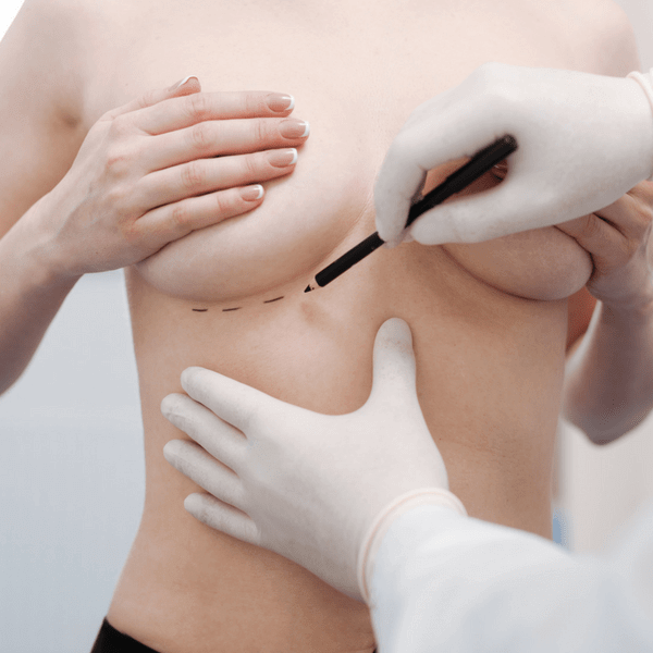 Mirabiliss Polyclinic - Nis - Breast asymmetry correction 03