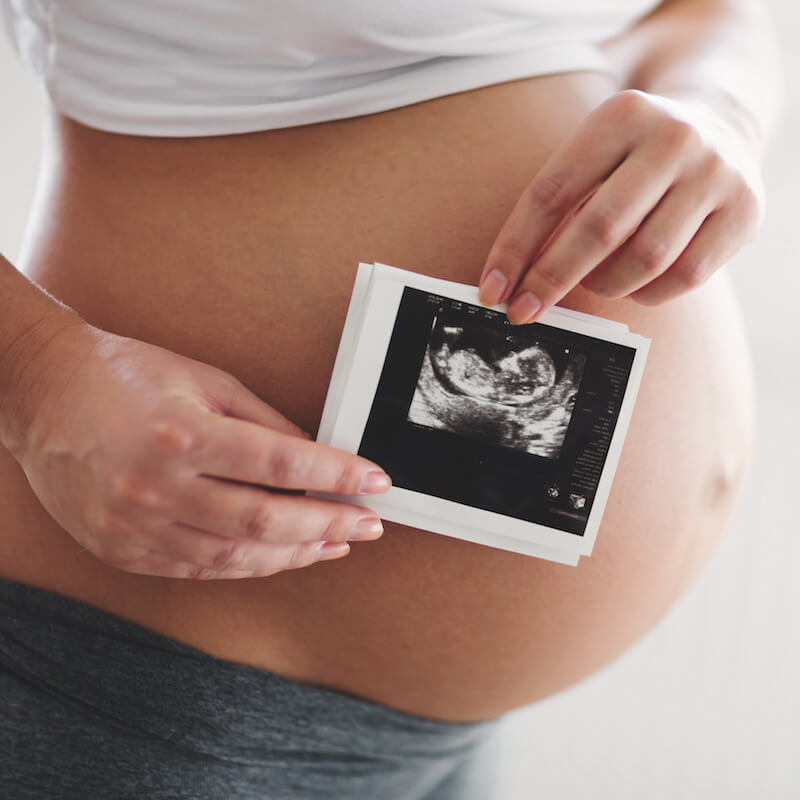 Mirabiliss Poliklinika, Niš - Vođenje i kontrola normalne i visokoriznične trudnoće 02